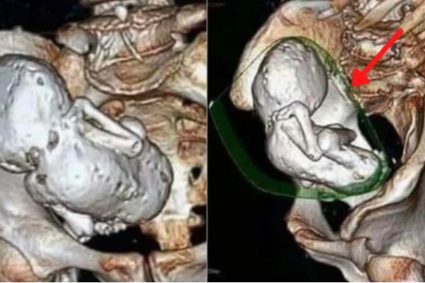 Bà lão 100 tuổi ngã bệnh rồi qua đời, sau đó đột ngột sống lại chơi mạt chược như thường, chuyên gia kiểm tra mới phát hiện chân tướng-6