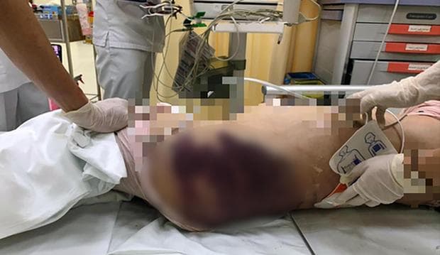 Xuân Lan, Thúy Diễm... cùng dàn sao Việt phẫn nộ với vụ án bé gái 8 tuổi nghi bị mẹ kế bạo hành đến chết-1