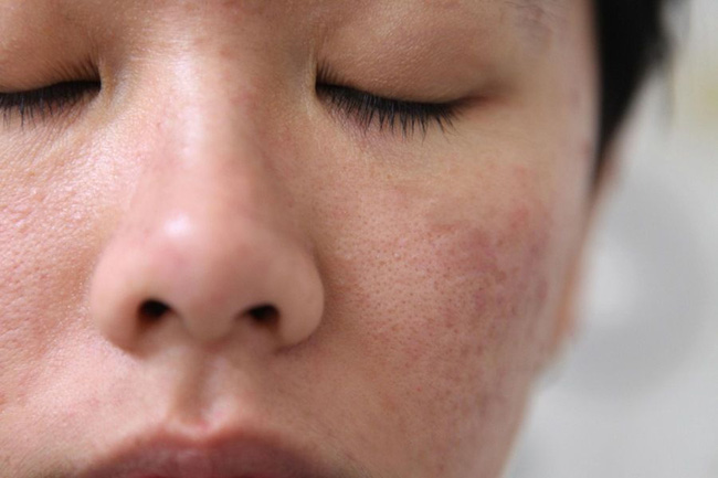Đại sứ chăm sóc da của Dior chỉ 4 điều phải thay đổi ngay lập tức khi skincare mùa lạnh-2