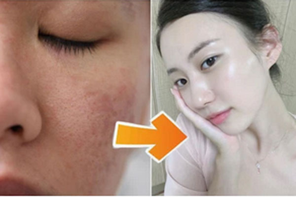 Buổi sáng rét đậm nhớ skincare đủ 4 bước này, da bạn sẽ căng mướt đến tận tối muộn-4