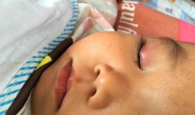Con trai vô tình nhỏ keo 502 vào mắt, người bố nhanh trí xử lý bằng cách này khiến bác sĩ không ngớt lời khen ngợi-2