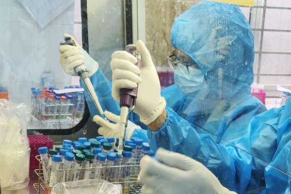 Mất vị giác, khứu giác do COVID-19 có nguy hiểm không? BS giải đáp và chỉ cách khắc phục-2