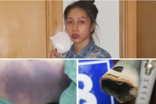 Nhìn lại vụ bé gái 8 tuổi ở TP.HCM bị mẹ kế bạo hành tử vong qua loạt tình tiết gây chấn động-10