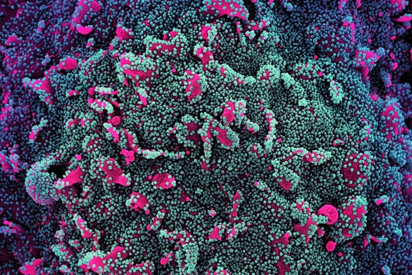 Phát hiện kháng thể có thể vô hiệu hóa biến chủng Omicron-1