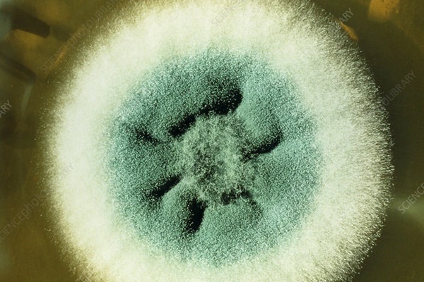 Loại nấm ‘rình rập’ bệnh nhân COVID-19, có thể đã giết chết hàng ngàn người-1