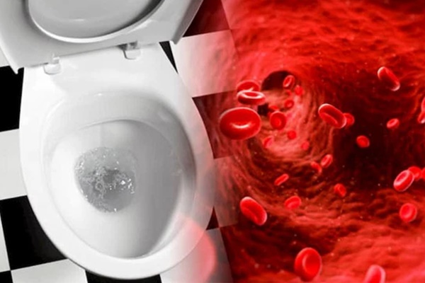 Tế bào ung thư âm thầm xâm chiếm hệ tiết niệu nếu bạn gặp 3 vấn đề khi đi tiểu, xem thử bạn có dấu hiệu nào không-1