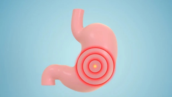 Nữ giáo viên 34 tuổi được chẩn đoán mắc ung thư dạ dày, bác sĩ tìm ra nguyên nhân đến từ thói quen uống trà hoa cúc-2