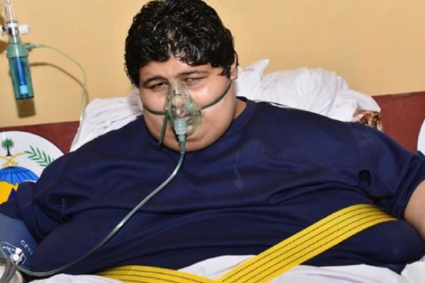 Thiếu niên béo nhất thế giới nặng 610kg, di chuyển phải dùng cần cẩu gây sốc khi trưởng thành, nhìn vào không ai dám tin là một người-1