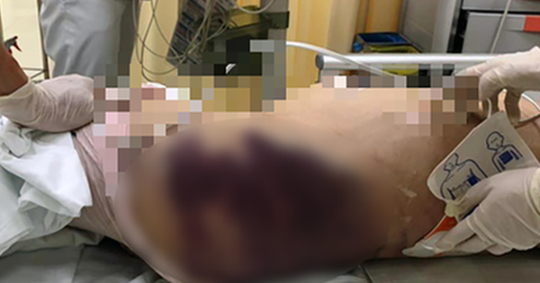 Vụ bé gái 8 tuổi ở TP.HCM: Luật sư tiết lộ về buổi học online cuối cùng, bạn bè của bé đều nghe tiếng phụ nữ la lối, đập đồ-2