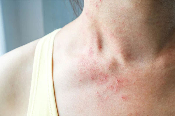 Kiểm tra phòng cho cô gái 20 tuổi thuê, chủ nhà gọi thợ thay khóa khẩn cấp-1