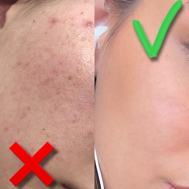 Làm đẹp cấp tốc ngày cận Tết: Mỡ bụng hay mụn nhọt đều sạch băng nhờ chế độ detox rau - củ - quả 483-2