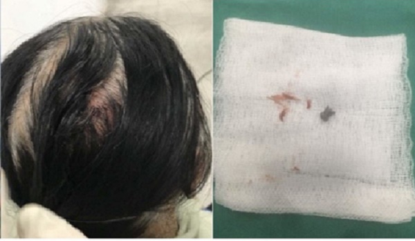 Hà Nội: Người phụ nữ nghi bị đạn lạc ở chung cư găm trúng đầu, 1 căn hộ cùng khu cũng bị bắn vỡ kính-2