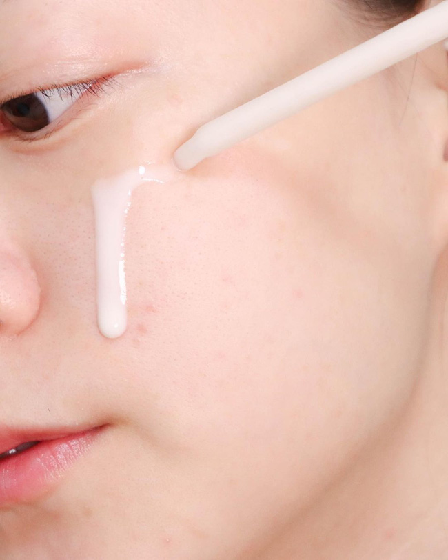 4 sản phẩm skincare chị em đừng dại dột dùng trước Tết, da sẽ xấu không kịp cứu vãn-1