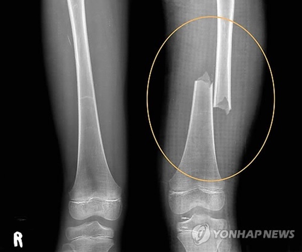 Mẹ kế hành hạ con riêng của chồng đến chết: 2 năm địa ngục bị phớt lờ, công tố viên bật khóc khi nghe file ghi âm giọng đứa trẻ-2