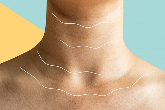 4 triệu chứng trên cổ ngầm cảnh báo 