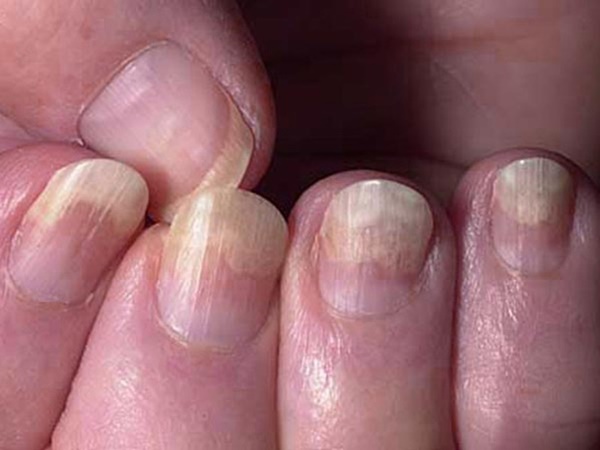 Gan có tốt hay không cứ nhìn vào 4 vùng trên cơ thể là rõ, đáng tiếc nhiều người chẳng hay biết-1