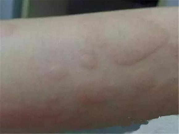 Hàng ngàn con ve chui ra khỏi nệm? Hướng dẫn bạn mẹo đuổi mạt dễ dàng mà không cần đun nước sôi hay phơi nắng-1