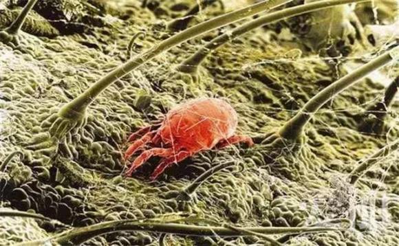 Hàng ngàn con ve chui ra khỏi nệm? Hướng dẫn bạn mẹo đuổi mạt dễ dàng mà không cần đun nước sôi hay phơi nắng-2