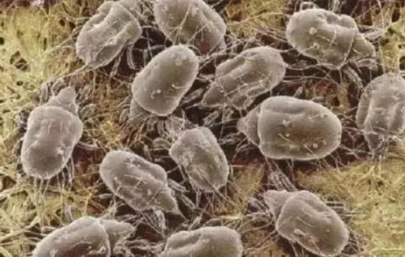 Hàng ngàn con ve chui ra khỏi nệm? Hướng dẫn bạn mẹo đuổi mạt dễ dàng mà không cần đun nước sôi hay phơi nắng-3