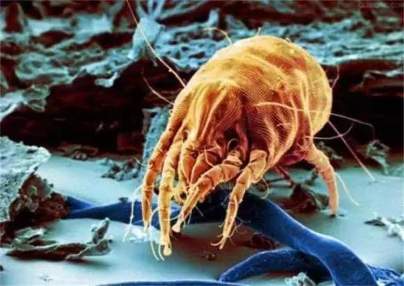 Hàng ngàn con ve chui ra khỏi nệm? Hướng dẫn bạn mẹo đuổi mạt dễ dàng mà không cần đun nước sôi hay phơi nắng-4