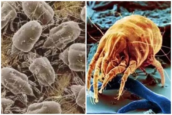 Hàng ngàn con ve chui ra khỏi nệm? Hướng dẫn bạn mẹo đuổi mạt dễ dàng mà không cần đun nước sôi hay phơi nắng