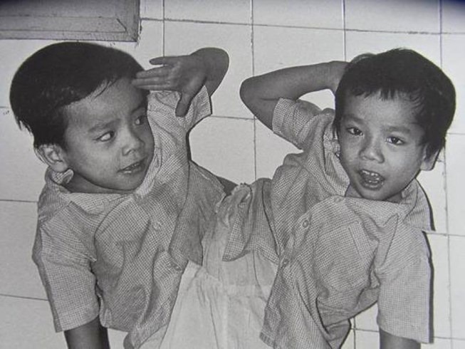 Cuộc sống hiện tại của người em sống sót trong ca tách rời lịch sử cặp sinh đôi Việt - Đức-1