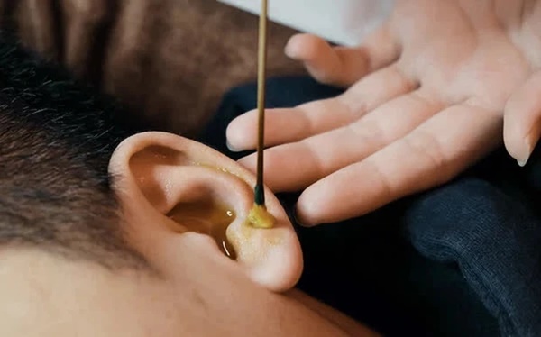 Cậu bé 6 tuổi đau nhức và nghe tiếng động lạ trong tai, đi nội soi bác sĩ hốt hoảng khi thấy con vật đang làm tổ bên trong-3