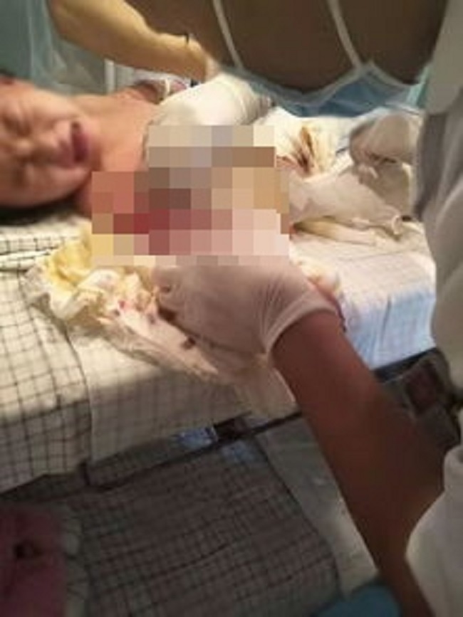 Mẹ tức tốc đưa con bị bỏng đi viện, bác sĩ lập tức báo cảnh sát bắt ả ác nữ vì một dấu hiệu trên cơ thể đứa trẻ-1