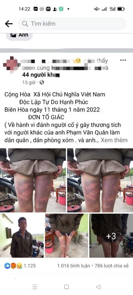 Làm rõ việc người đàn ông tố bị công an xã đánh bầm tím khi đến nhà vợ cũ thăm con-1