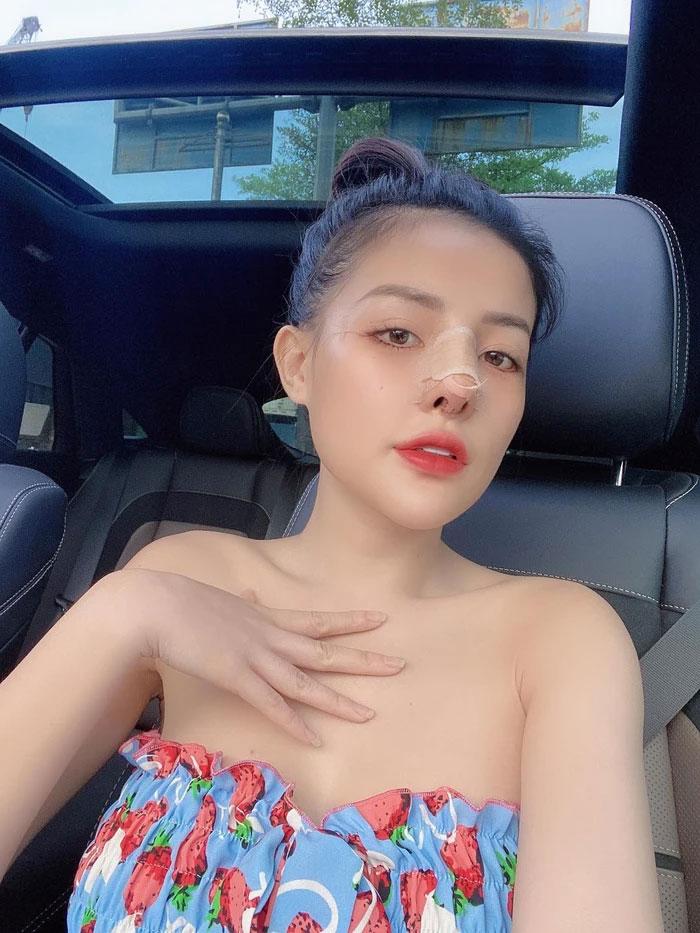 Dao kéo đón Tết, Ngân 98 bị soi lỗ mũi bên to bên nhỏ, méo mó-6