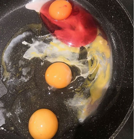 Đang chiên trứng phát hiện quả trứng có lòng trắng màu hồng trông đẹp mắt, người phụ nữ suýt ăn phải Tử thần nếu không đăng đàn chia sẻ-1