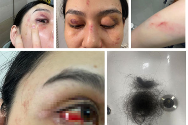 HOT: Chồng của người phụ nữ bị đánh ở shop Trang Nemo lên tiếng hẹn trưa nay live trực tiếp giải quyết rõ sự việc?-2