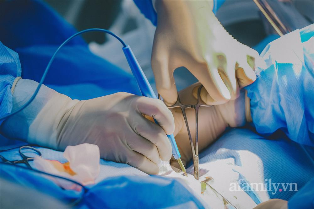 Cận cảnh 30 phút sinh tử mở khí quản cho bệnh nhân COVID-19 nguy kịch tại lá chắn cuối cùng-14