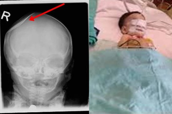 Bé 8 tháng vào viện với hộp sọ bị nứt, 4 tháng sau cảnh sát bắt giữ 2 thủ phạm là kẻ không ai ngờ với thái độ thờ ơ đáng sợ