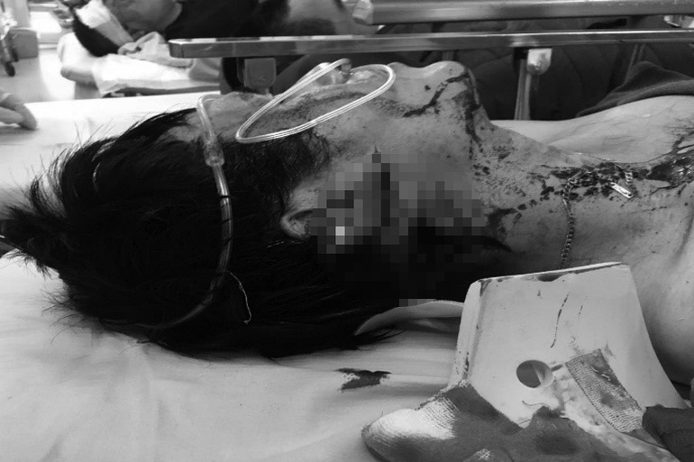 Công an Hà Nội cảnh báo sau hàng loạt vụ cướp manh động-4