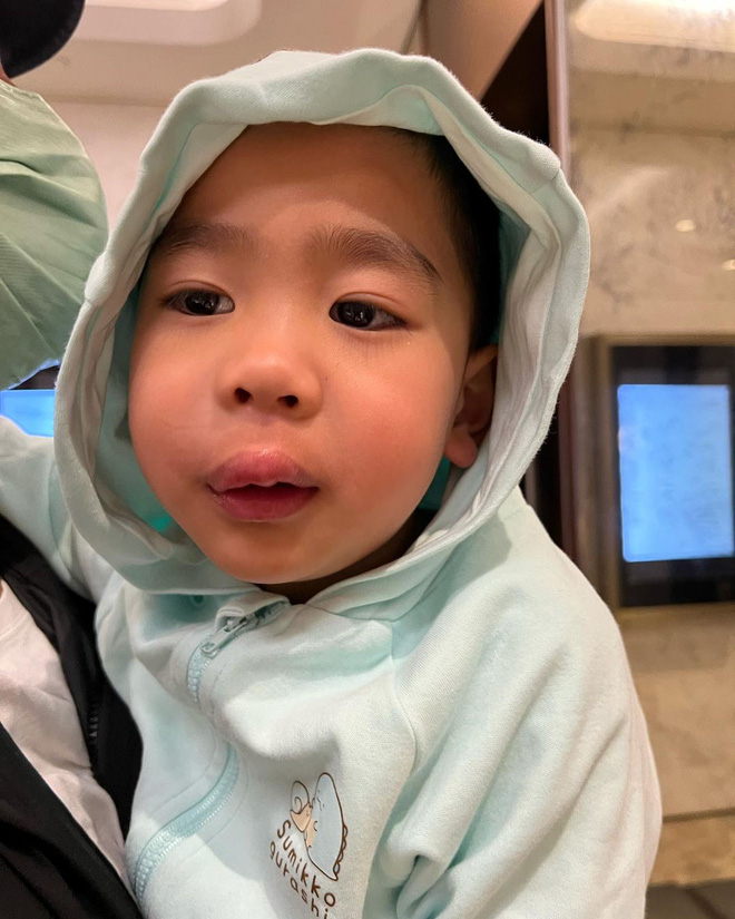 Nữ diễn viên nhận gạch đá khi để con trai sưng vều môi dẫn đến sốt cao, tất cả vì 1 thói quen nhiều bà mẹ mắc phải-2