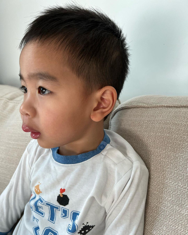 Nữ diễn viên nhận gạch đá khi để con trai sưng vều môi dẫn đến sốt cao, tất cả vì 1 thói quen nhiều bà mẹ mắc phải-3