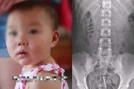 Bé gái 10 tháng tuổi bị 12 cây kim đâm vào cơ thể, kẻ thủ ác bị vạch trần bằng câu hỏi vu vơ, động cơ phía sau gây rùng mình