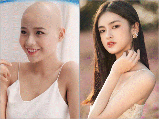 Vụ cô gái ung thư thi Miss World Việt Nam: Ekip xin lỗi vì ghi nhầm danh hiệu, động thái Hoa khôi real gây chú ý-1