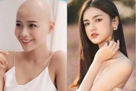 Vụ cô gái ung thư thi Miss World Việt Nam: Ekip xin lỗi vì ghi nhầm danh hiệu, động thái 'Hoa khôi real' gây chú ý