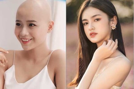 Vụ cô gái ung thư thi Miss World Việt Nam: Ekip xin lỗi vì ghi nhầm danh hiệu, động thái 