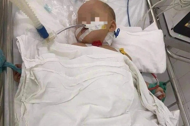 Bé gái 3 tuổi nghi bị bạo hành ở Hà Nội: Nhiều vết thương trên đầu lâu ngày đã đóng vẩy, cánh tay từng phải bó bột cách đây 2 tuần-1