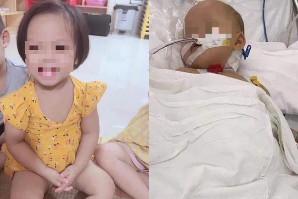 Vụ bé gái 3 tuổi có đinh găm ở đầu: Mẹ có biểu hiện không bình thường, cha dượng có thể bị điếc bẩm sinh-2