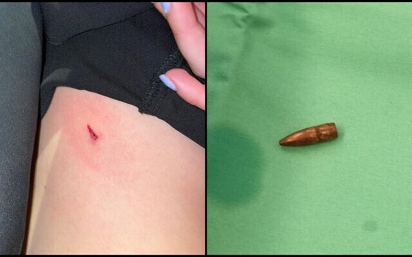 Đang dự đám cưới bạn, cô gái đột nhiên thấy người đau đớn, 3 tháng sau đi kiểm tra phát hiện sự thật không ngờ-3