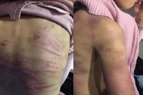 Vụ bé gái 3 tuổi ở Hà Nội: Người mẹ nhiều lần đưa con đi cấp cứu nhưng không có tiền, ông nội phải vay mượn để trả viện phí-4