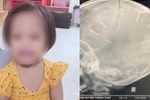 NÓNG: Xác định nghi phạm chính vụ bé gái 3 tuổi nghi bị bạo hành ở Hà Nội là người tình của mẹ-3