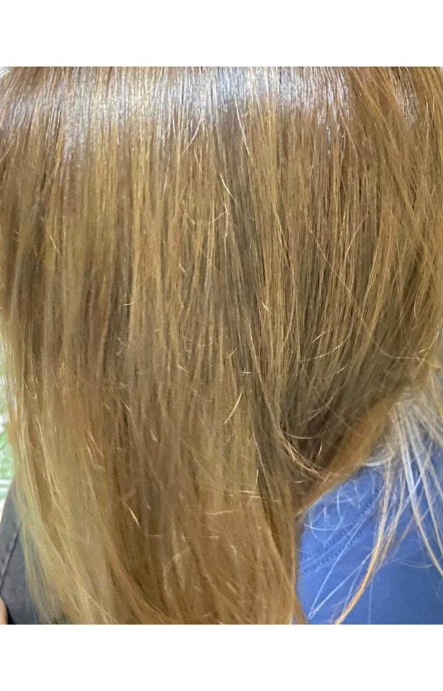 Tẩy tóc chơi Tết, ngồi 11 tiếng nhận về cái kết cháy da đầu, chảy dịch mủ-2