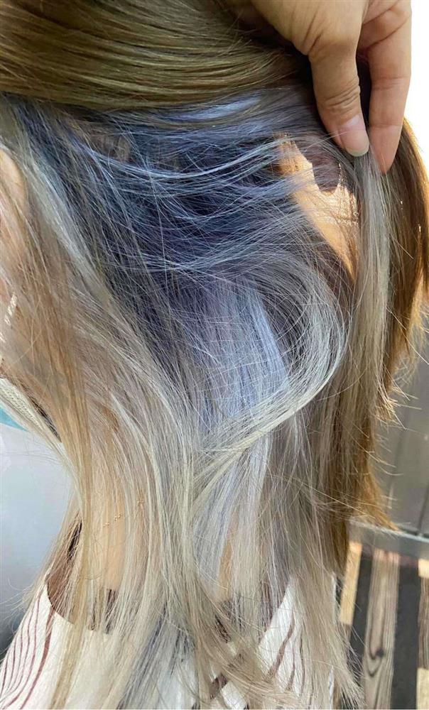 Tẩy tóc chơi Tết, ngồi 11 tiếng nhận về cái kết cháy da đầu, chảy dịch mủ-3
