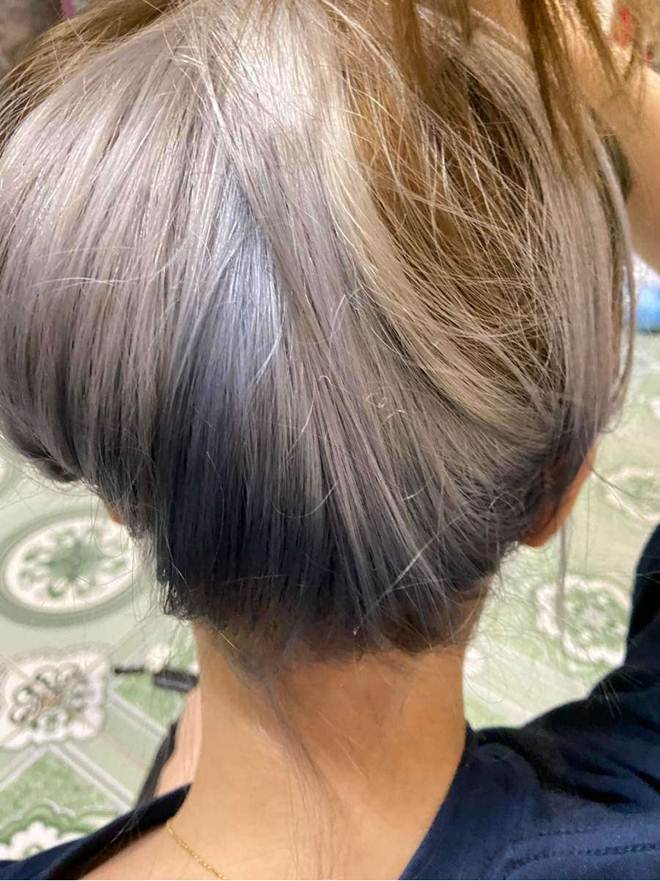 Tẩy tóc chơi Tết, ngồi 11 tiếng nhận về cái kết cháy da đầu, chảy dịch mủ-8