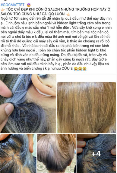 Tẩy tóc chơi Tết, ngồi 11 tiếng nhận về cái kết cháy da đầu, chảy dịch mủ-1